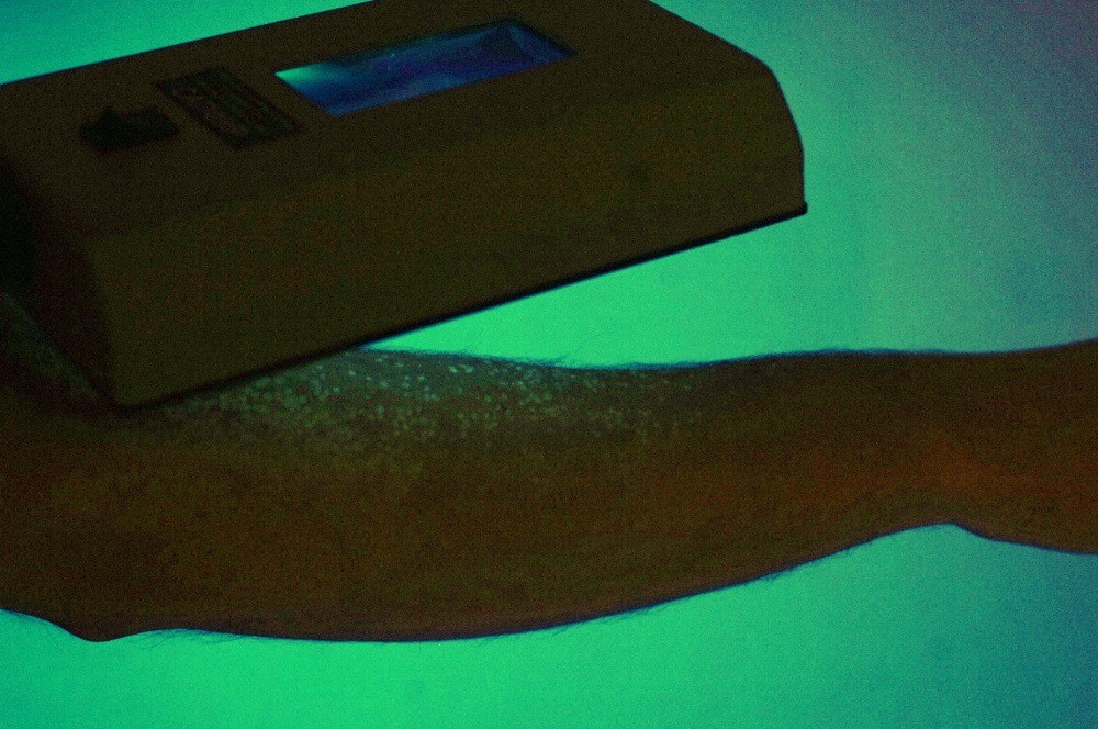 Облучатель люминесцентный для диагностики грибковых поражений кожи «Сапфир»  (лампа Вуда с РУ)