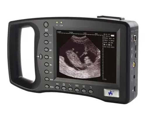 WED-2000 AV Ультразвуковой диагностический сканер