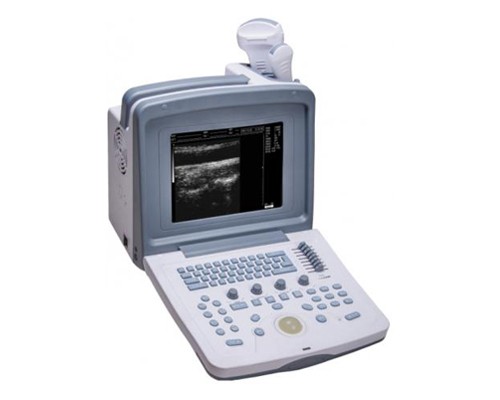 WED-9618 V Ультразвуковой диагностический сканер